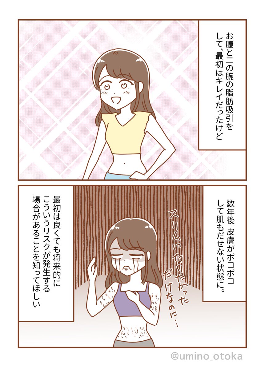 umino_otoka's tweet photo. 【体験談】
脂肪吸引したら数年後に肌がボコボコになった話🤕
#整形 https://t.co/vggC5m4cFC