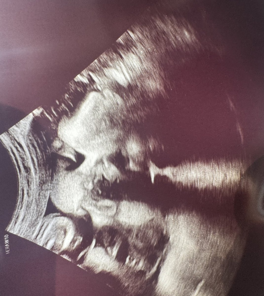 p4rma 🪃 tweet media