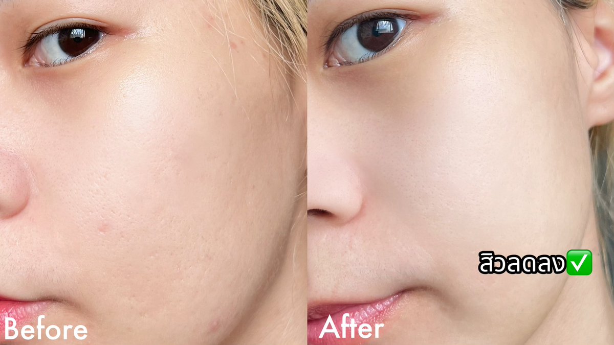 บูสๆๆ ผิวหน้าสงกรานต์ เล่นน้ำมันส์แค่ไหนก็ไม่มีมอม หยิบมากินบูสไปเลย Jelly Me ZinC เจลลี่ลดสิว น้องเป็นกลิ่นพีชนะ 🍑 เนื้อเจลลี่หอมอร่อยย นี่ชอบเอาไปแช่เย็นฟินกว่าเดิม 20฿ 📍 7-11 ทุกสาขา 

#JellyMe #JellyMeCuti #ความคิวทิบิลด์ง่ายได้ทุกวัน #JellyMeZinc #ลดสิว #HowtoPerfect https://t.co/1NlGuHuMDD