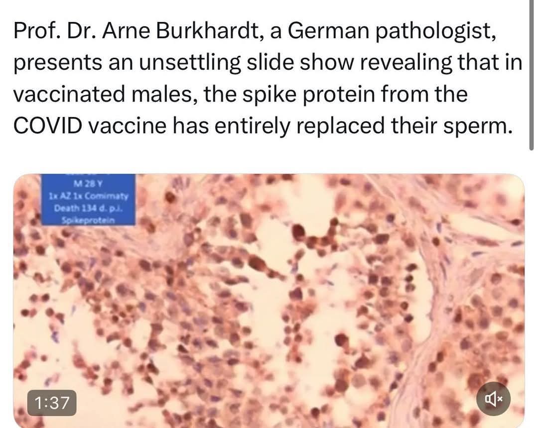 Coba dong yang udah booster 2-3 x pijer atau moderna atau astrajenaka tolong periksa air maninya di laboratorium🙏

Sebelumnya, pengecekan ini sudah di lakukan oleh dokter Korea &amp; dr. Anna Maria Mihalcea. 

Dan memang mereka menemukan nanopartikel di dlm cairan sperma.