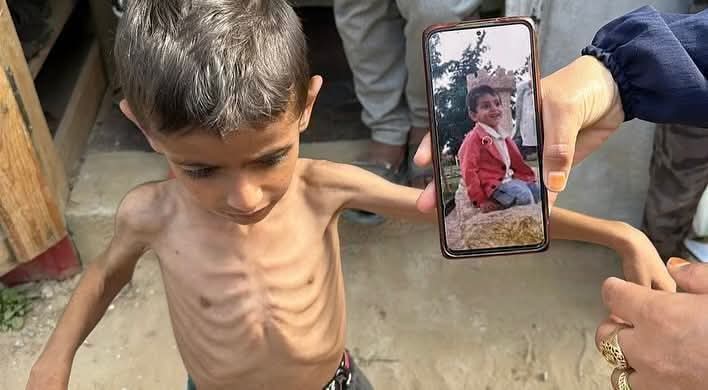 أطفالنا ما بين القتل المجاعة والعطش والحر هل ترضيكم هذه الأجساد يا عالمًا فقد إنسانيته!