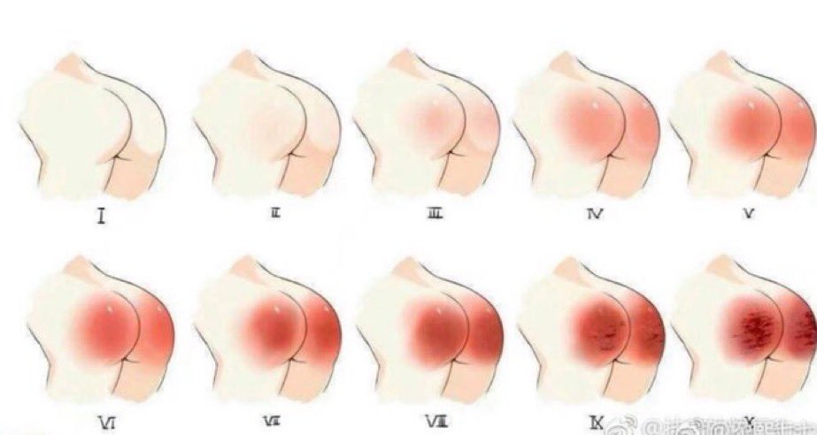 내가 즐기는 플은 3 최대 버틸 수 있는 강도는 4-5정도 인듯…?

ㅎㅎ 주인님께 공부는 안하고 또 스팽 생각에 젖었음을 혼나고 싶은 새벽…🌙✨🤍

#스팽 #펨키 #구인 #스팽구인 #spank #유플 #체벌 #엉덩이체벌 #회초리 #엉덩이회초리 #멜커 #스팽플