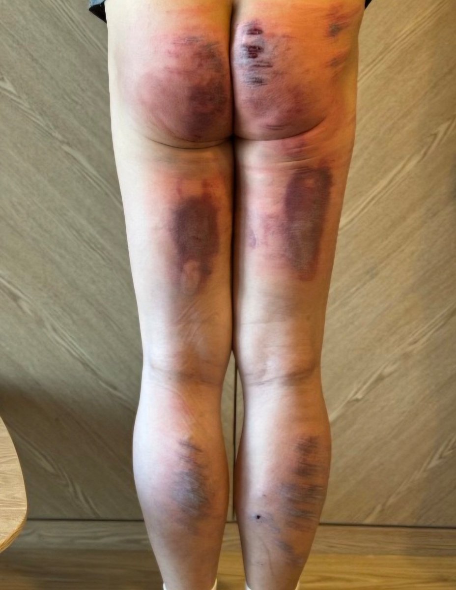 매를 맞다가 고통의 한계에 다다르면, 군대에서처럼 악으로 깡으로 버티는 것밖에 방법이 없다. 이는 돔을 신뢰하는 마음에서 비롯된다. 신뢰가 있기 때문에 섭은 돔의 지시를 따르고, 그 고통을 감수할 수 있는 것이다.