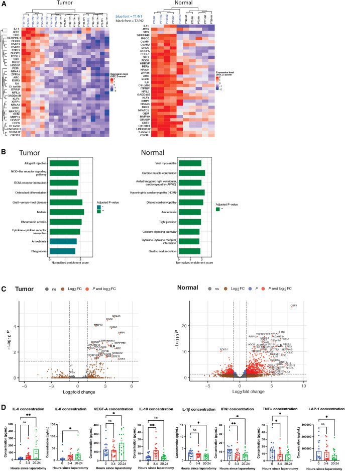 MSK Library (@msklibrary) on Twitter photo Featured today by <a href="/MSKLibrary/">MSK Library</a>: Evolution of tumor stress response during cytoreductive surgery for ovarian cancer dx.doi.org/10.1016/j.isci…
#OvarianCancer #SurgicalStress #CytoreductiveSurgery #CancerImmunology #PerioperativeCare #CancerResearch #CancerSurgery #WomensHealth Featured today by <a href="/MSKLibrary/">MSK Library</a>: Evolution of tumor stress response during cytoreductive surgery for ovarian cancer dx.doi.org/10.1016/j.isci…
#OvarianCancer #SurgicalStress #CytoreductiveSurgery #CancerImmunology #PerioperativeCare #CancerResearch #CancerSurgery #WomensHealth