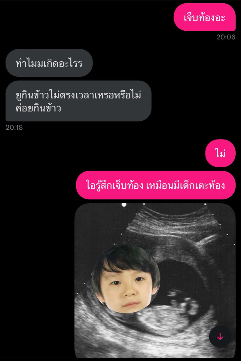 เจ็บท้องจังเลยค่ะ 🥺