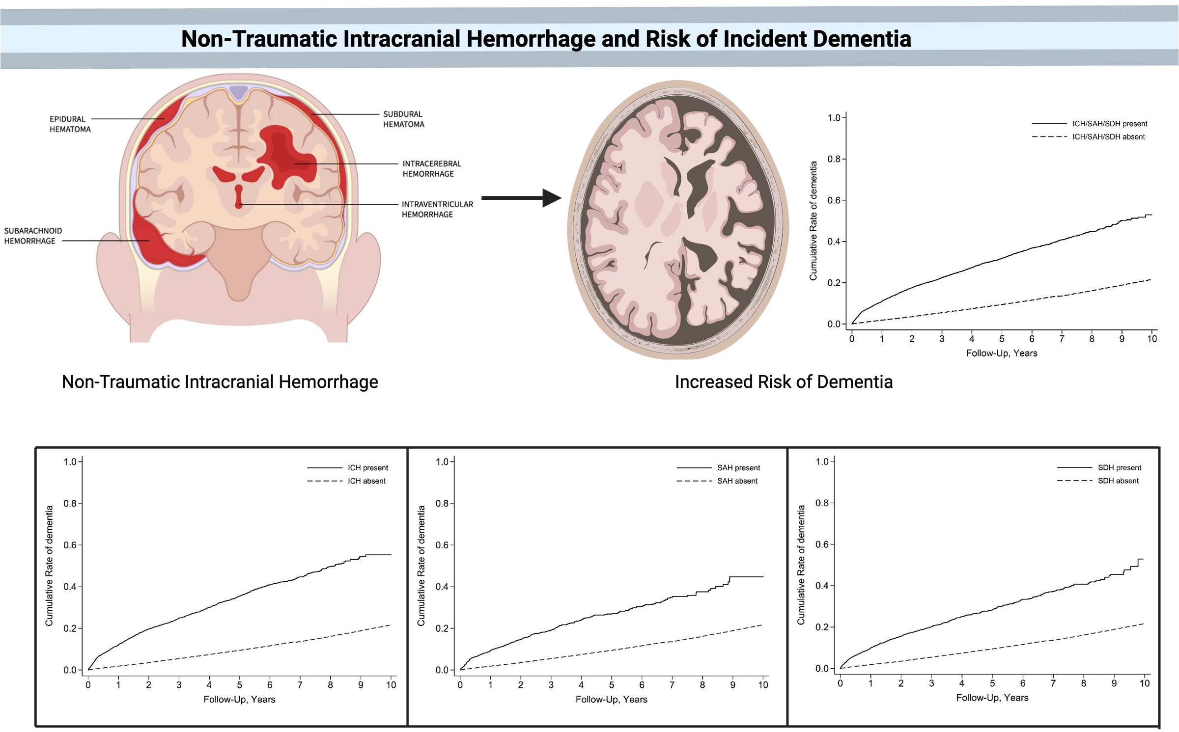 New Insights in Intracerebral Hemorrhage (Frontiers of
