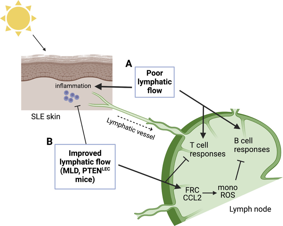 Waggoner Lab (@labwaggoner) on Twitter photo Lymphatic dysfunction in lupus contributes to cutaneous photosensitivity and lymph node B cell responses <a href="/jclinicalinvest/">Journal of Clinical Investigation</a> <a href="/TheresaLuLab/">Theresa Lu Lab</a>
jci.org/articles/view/… Lymphatic dysfunction in lupus contributes to cutaneous photosensitivity and lymph node B cell responses <a href="/jclinicalinvest/">Journal of Clinical Investigation</a> <a href="/TheresaLuLab/">Theresa Lu Lab</a>
jci.org/articles/view/…