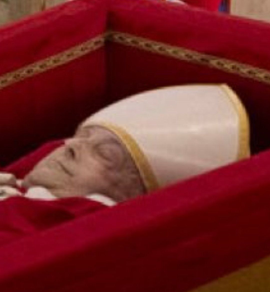 O corpo do Papa Francisco foi revelado ao público, e observadores notaram hematomas visíveis no lado esquerdo de seu rosto.

O único relato público de sua queda data do início deste ano.

A causa do óbito foi um AVC que levou ao coma e colapso cardiocirculatório irreversível.