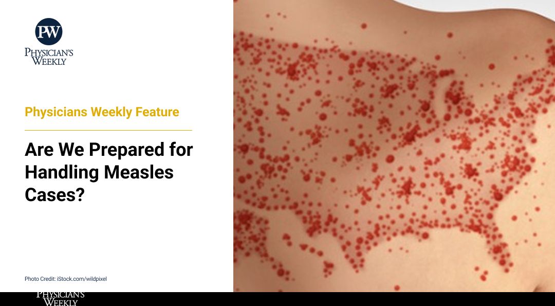 The rise in US measles cases, fueled by misinformation, is alarming. This isn't a benign childhood illness. Let's refresh our knowledge, confidently guide patients towards evidence-based care, and stand firm against dangerous myths. buff.ly/J6s03EN 

#MedEd