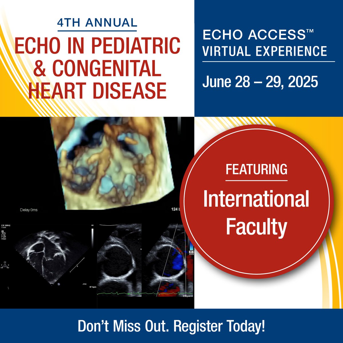 Our 4th Annual Echo in Pediatric &amp; Congenital Heart Disease is a virtual course, presenting the latest information on established &amp; emerging #CVultrasound technologies, clinical care &amp; practical considerations in children &amp; adults with CHD. 🫀

Sign up: bit.ly/3yR7NXg