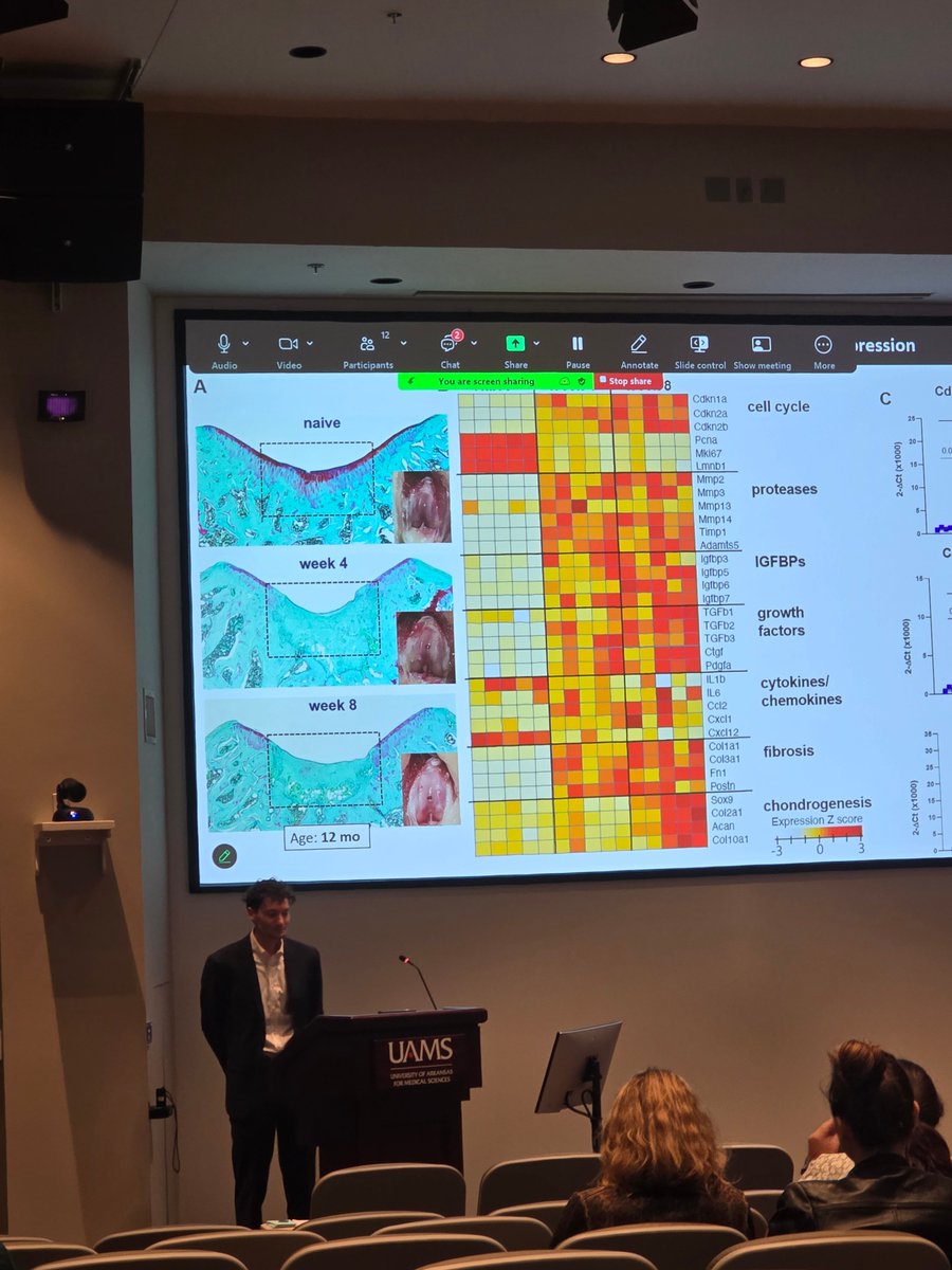 UAMS Physiology & Cell Biology (@uams_physiology) on Twitter photo Luke Childress Defended his Dissertation Tuesday April 22nd, 2025. It was Titled "Contributions of cellular senescence to inferior Articular cartilage healing".
His Major Advisor was Dr. Ryan Porter, PhD.
<a href="/UAMS_COM/">UAMS College of Medicine</a> <a href="/uamshealth/">UAMS Health</a> Luke Childress Defended his Dissertation Tuesday April 22nd, 2025. It was Titled "Contributions of cellular senescence to inferior Articular cartilage healing".
His Major Advisor was Dr. Ryan Porter, PhD.
<a href="/UAMS_COM/">UAMS College of Medicine</a> <a href="/uamshealth/">UAMS Health</a>