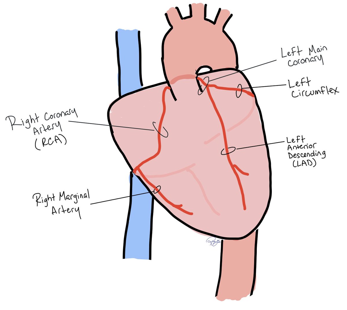 Rebecca Garber (@bexg_md) on Twitter photo New chapter drop! Learn about the mechanical, pericardial, thrombotic, and electrical complications of MI whenthebeatdrops.org/content/mi-com…
<a href="/KatieVanchiere/">Katie Vanchiere, MD, MA (she/her)</a>, Drew Carlson, Dr. Amer Ardati New chapter drop! Learn about the mechanical, pericardial, thrombotic, and electrical complications of MI whenthebeatdrops.org/content/mi-com…
<a href="/KatieVanchiere/">Katie Vanchiere, MD, MA (she/her)</a>, Drew Carlson, Dr. Amer Ardati