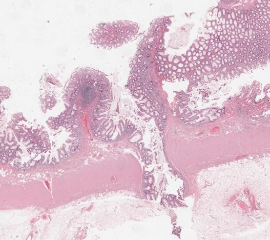 CooperPathology tweet media