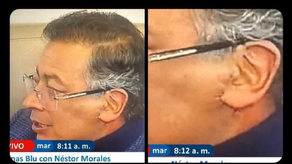 Petro haciéndose lifting facial mientras tu mamá se desmaya en la fila de la EPS. 

✨Prioridades✨