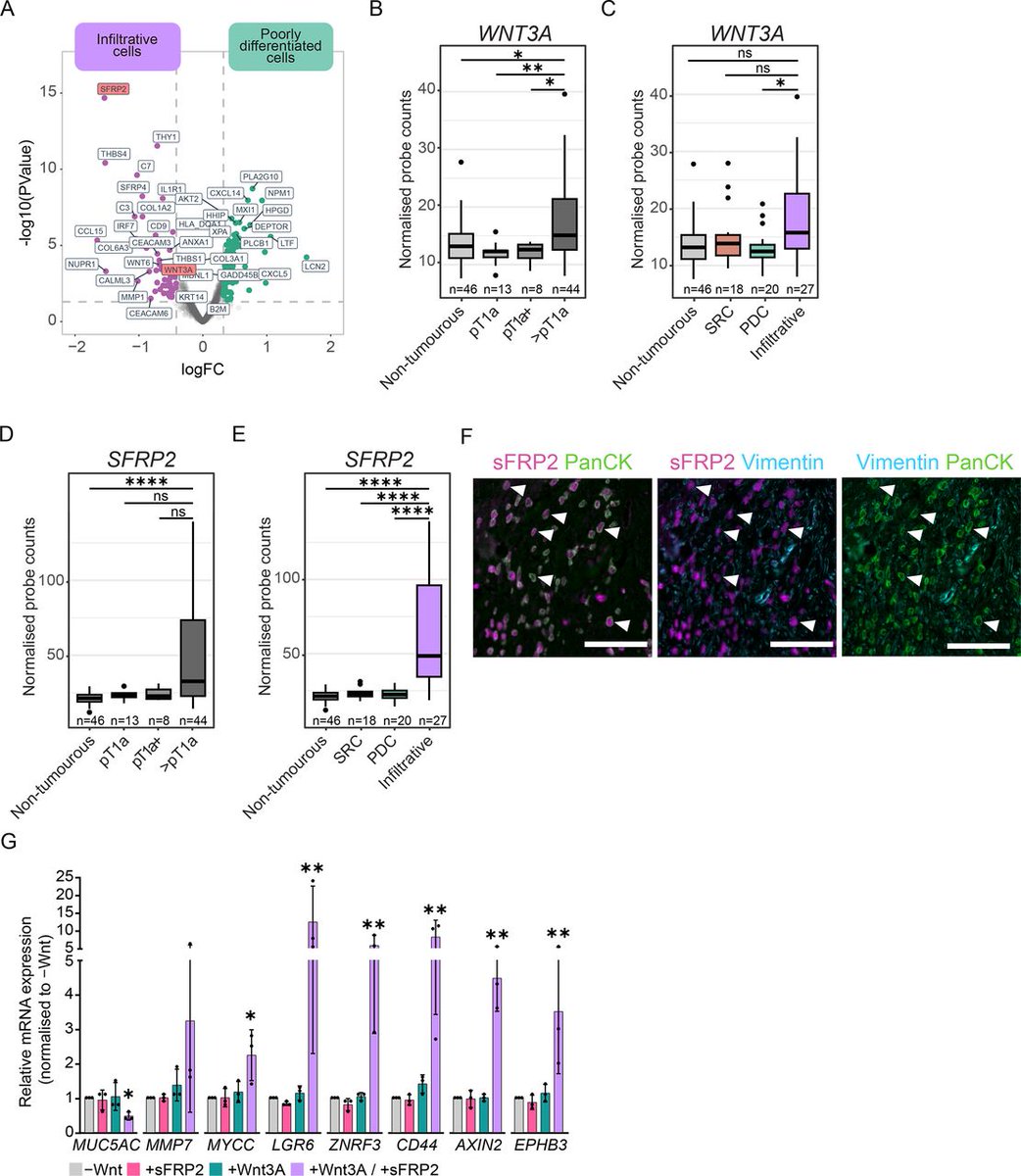 Gut Journal (@gut_bmj) on Twitter photo #GUTOnline paper by Kemp et al entitled
"Tumour-intrinsic alterations and stromal matrix remodelling promote Wnt-niche independence during diffuse-type gastric cancer progression" via
bit.ly/42B7gJb
<a href="/drcolinwood/">colin_wood</a> <a href="/nigeljamieson/">Nigel B. Jamieson</a> @Gloerichlab #GastricCancer #GUTOnline paper by Kemp et al entitled
"Tumour-intrinsic alterations and stromal matrix remodelling promote Wnt-niche independence during diffuse-type gastric cancer progression" via
bit.ly/42B7gJb
<a href="/drcolinwood/">colin_wood</a> <a href="/nigeljamieson/">Nigel B. Jamieson</a> @Gloerichlab #GastricCancer
