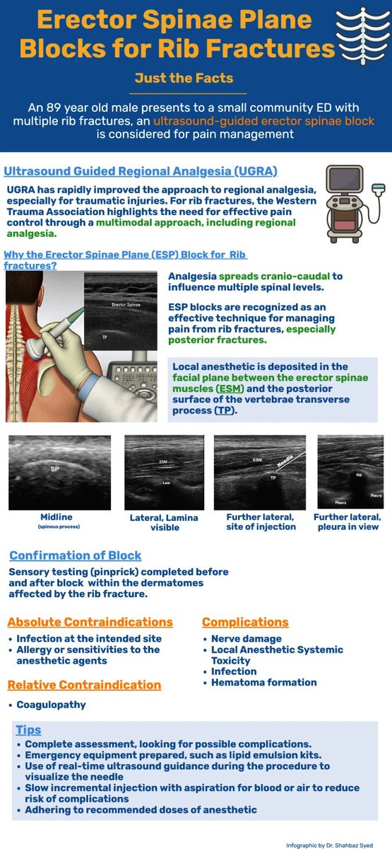 CJEM (@cjemonline) on Twitter photo Just the facts: erector spinae plane blocks for rib fractures in the emergency department by <a href="/uOttawamwoo/">Michael Woo</a> rdcu.be/eiOfA
How is this block performed and what are some tips to maximize your success? This and more in this JTF! Just the facts: erector spinae plane blocks for rib fractures in the emergency department by <a href="/uOttawamwoo/">Michael Woo</a> rdcu.be/eiOfA
How is this block performed and what are some tips to maximize your success? This and more in this JTF!