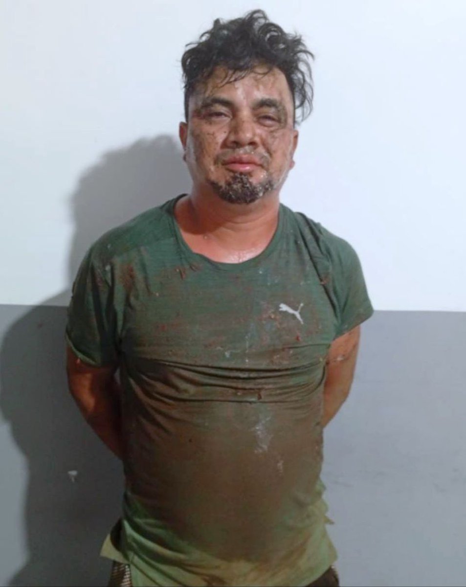 José Luis Bonilla Membreño, de 22 años, apuñaló a su compañera de vida de 18 años, quien está embarazada.

El ataque ocurrió en su vivienda, en San Marcos Lempa, Jiquilisco, Usulután Oeste.

La víctima recibe atención médica en el hospital, sin embargo está estable. 

El sujeto