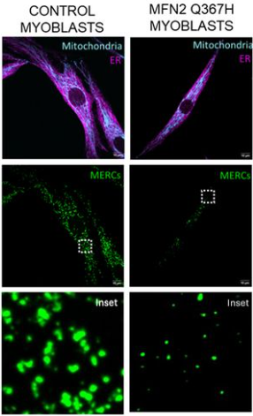 Gerald Pfeffer tweet media