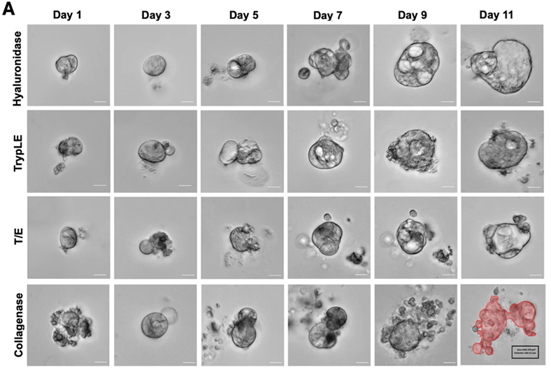 Organoid News (@organoidscience) on Twitter photo This <a href="/SciReports/">Scientific Reports</a> study underscores the critical influence of enzymatic dissociation methods on the establishment and reliability of colorectal cancer patient-derived #organoids, providing a foundation for optimizing patient-derived organoid protocols. ⚗️ 📝 This <a href="/SciReports/">Scientific Reports</a> study underscores the critical influence of enzymatic dissociation methods on the establishment and reliability of colorectal cancer patient-derived #organoids, providing a foundation for optimizing patient-derived organoid protocols. ⚗️ 📝