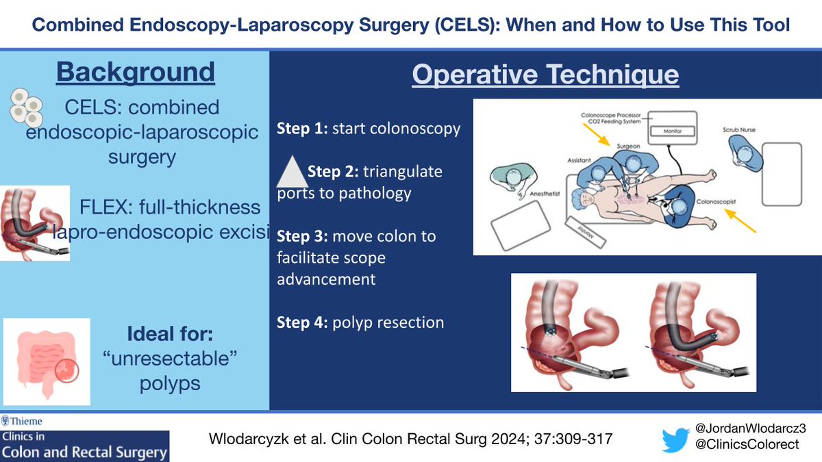 ClinicsColorectal (@clinicscolorect) on Twitter photo CELS: a novel surgical technique for the difficult polyp! <a href="/JordanWlodarcz3/">Jordan Wlodarczyk</a> <a href="/Sangwleemd/">Sang W. Lee, MD</a> <a href="/LWeaver_MD/">Lauren Weaver</a> <a href="/valevilchezp/">Valery Vilchez</a> CELS: a novel surgical technique for the difficult polyp! <a href="/JordanWlodarcz3/">Jordan Wlodarczyk</a> <a href="/Sangwleemd/">Sang W. Lee, MD</a> <a href="/LWeaver_MD/">Lauren Weaver</a> <a href="/valevilchezp/">Valery Vilchez</a>