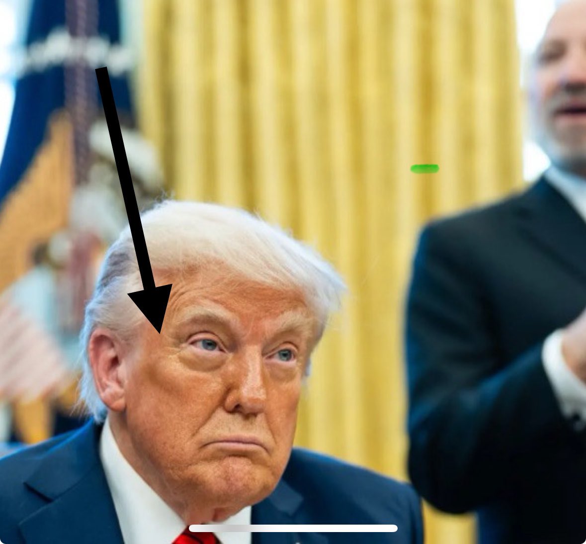 What’s the name of this plastic surgery?