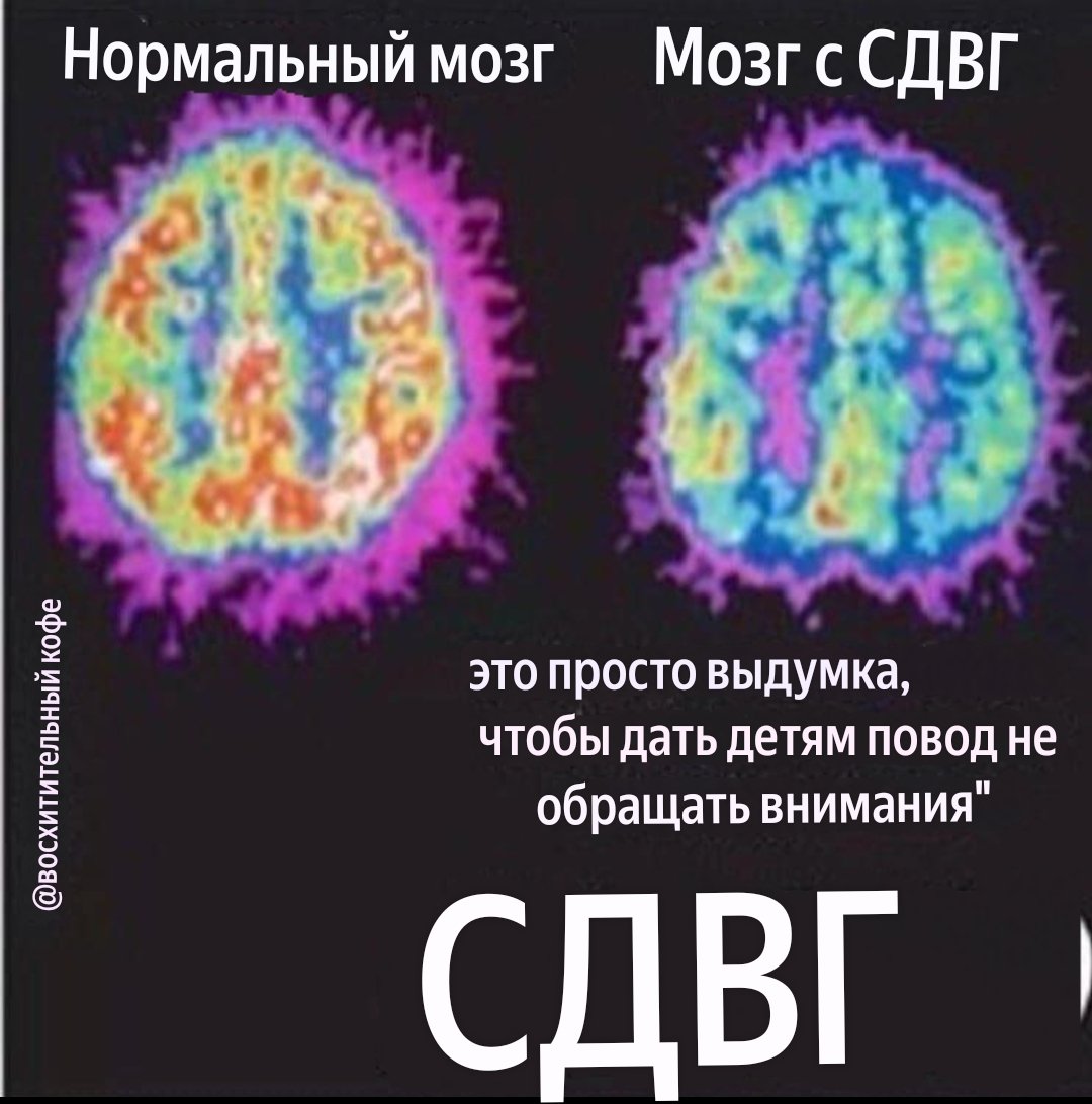 Мне было бы достаточно Рецепта на Препараты от СДВГ/ADHD и Полное Выполнение государственных Гарантий перед Инвалидом 2 группы! ☝♿ Но Не в Этой Жизни не на Этой Гнилой Планете!!!