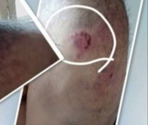 Andjela_Sipovac's tweet photo. #Atention #Syria #Alawites #AlawiteMasacre #AlawiteGenocide #StopAlawiteGenocideInSyria #RussiaSaveAlawites A young man in one of the villages in Homs province, who had not served in the military and had no criminal record, was detained by terrorists from the so-called public security forces.
He was brutally beaten and tortured until he lost consciousness, then thrown to the ground and left behind.
In addition to the beatings, bite marks were found on the victim, once again proving that the jihadists are nothing more than rabid dogs.