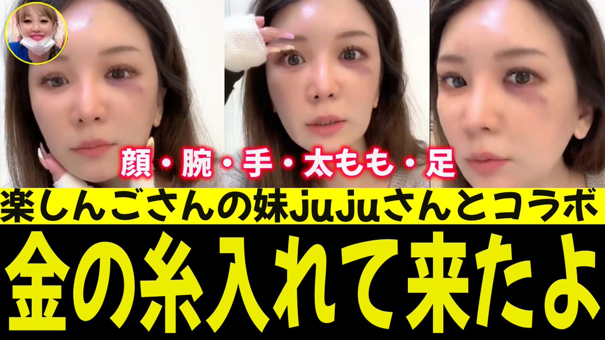 金の糸(全身)入れてきました！
楽しんごさんの妹、jujuさんのお店

youtu.be/xJ14TVlp4KM