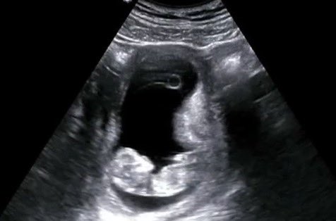 Little man makes his debut this November!!