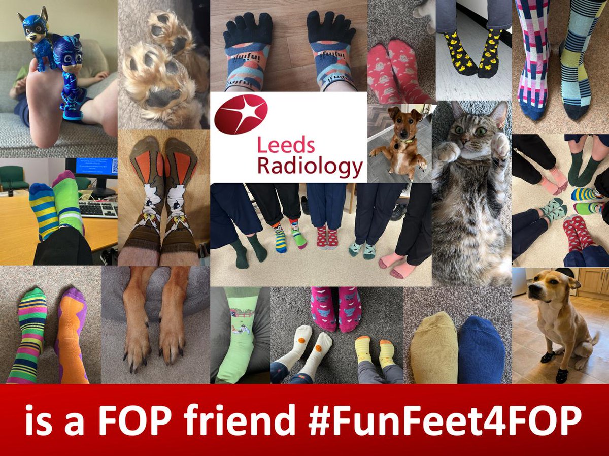 LTHT Radiology (@leedsradiology) on Twitter photo We have been getting involved with Fibrodysplasia Ossificans Progressiva (FOP) awareness day! #FunFeet4FOP <a href="/FOPFriends/">FOP Friends</a> We have been getting involved with Fibrodysplasia Ossificans Progressiva (FOP) awareness day! #FunFeet4FOP <a href="/FOPFriends/">FOP Friends</a>