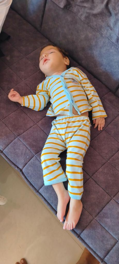 SbccHealth's tweet image. રાષ્ટ્રીય બાળ સ્વાસ્થ્ય કાર્યક્રમ અંતર્ગત ઉપલેટા તાલુકાની કેશવીને જન્મજાત ક્લેફ્ટ પેલેટ(તૂટેલ ટાળવું )ની ખામી ધ્રુવ હોસ્પિટલ રાજકોટમાં વિના મૂલ્યે સર્જરી કરી ખામી દૂર કરવામાં આવી @RajkotCdho00031 @DDORAJKOT1 @CollectorRjt @NHMGujarat @GujHFWDept