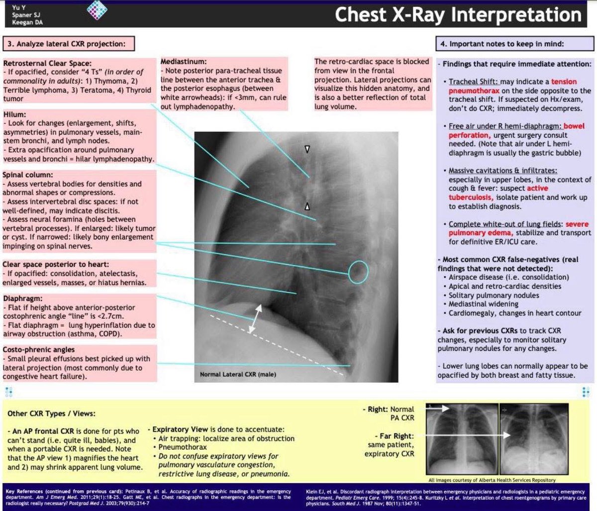 Chest Xray interpretation
