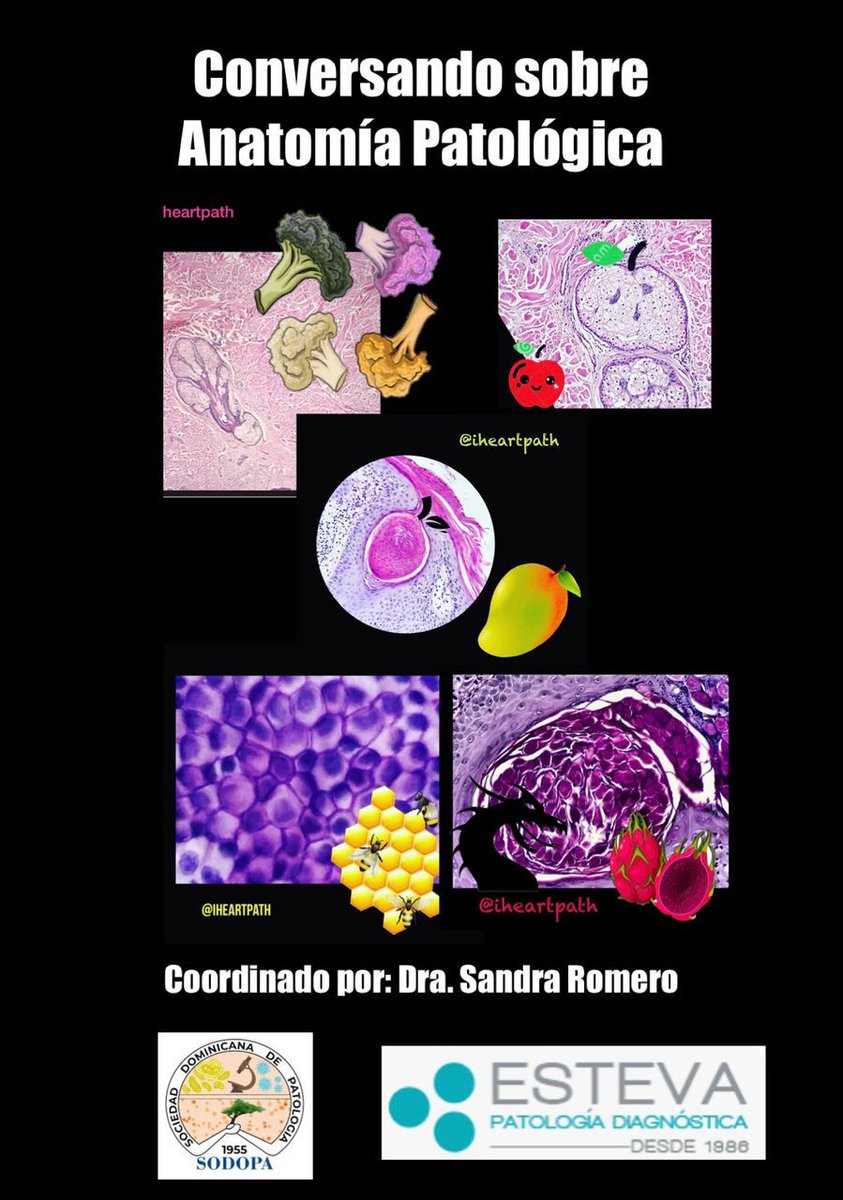 Los invitamos a unirse a nuestra reunión Zoom "Conversando sobre Anatomía Patológica". 
Mañana Jueves 24 abril 2025
 07:00 PM. Santo Domingo

MODULANDO LA EPIGENÉTICA: NUTRICIÓN Y CÁNCER
Dra. Maria Alejandra Torres Viera.
Hemato-oncólogo

Inscríbanse en:
us02web.zoom.us/meeting/regist…