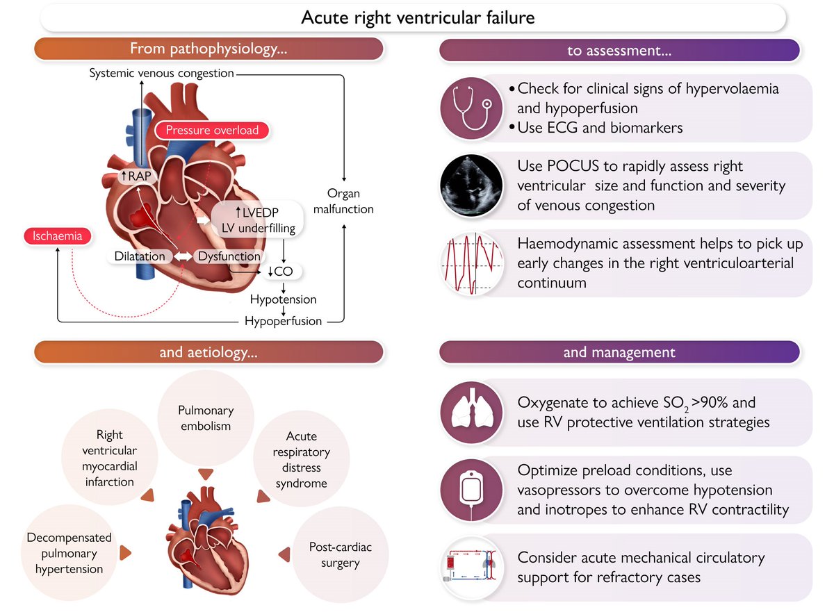 EHJ Editor-in-Chief (@ehj_ed) on Twitter photo Acute right ventricular failure: pathophysiology, aetiology, assessment, and management. A State-of-the-Art review just published in #EHJ. Read more 👉
academic.oup.com/eurheartj/adva…
<a href="/escardio/">European Society of Cardiology</a> <a href="/ESC_Journals/">European Society of Cardiology Journals</a> Acute right ventricular failure: pathophysiology, aetiology, assessment, and management. A State-of-the-Art review just published in #EHJ. Read more 👉
academic.oup.com/eurheartj/adva…
<a href="/escardio/">European Society of Cardiology</a> <a href="/ESC_Journals/">European Society of Cardiology Journals</a>