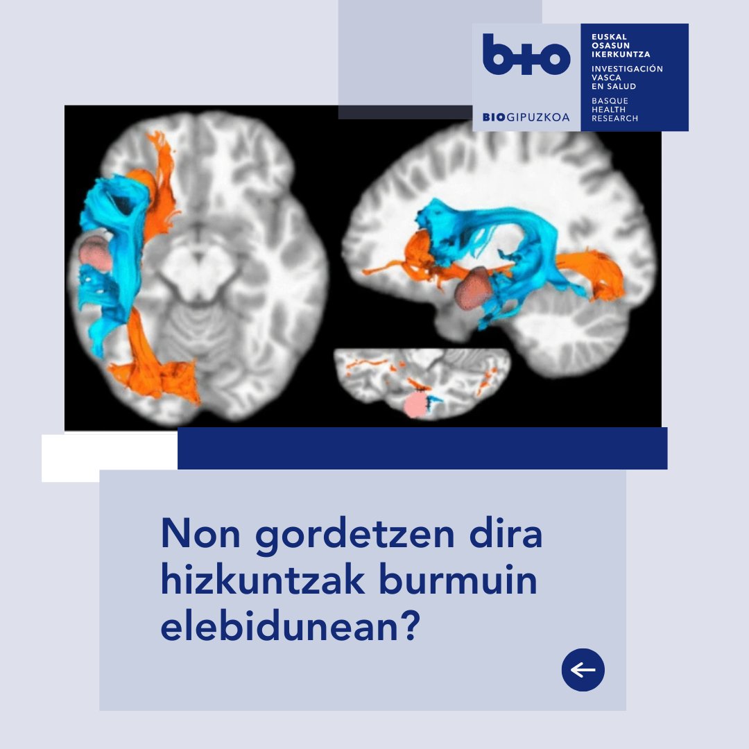 Biogipuzkoa (@biogipuzkoa) on Twitter photo Ileana Quiñones, #Biogipuzkoa-ko #Ictus taldeko koarduraduna, ikerketa baten buru izan da non hizkuntzak garun elebidunetan non kokatzen diren aztertu den 🧠
📝 f.mtr.cool/orxokbrsev
🔗 f.mtr.cool/ytaspfpmak
#BiogipuzkoaPaper <a href="/ICTUS_BioG/">ICTUS-BioGipuzkoa</a> Ileana Quiñones, #Biogipuzkoa-ko #Ictus taldeko koarduraduna, ikerketa baten buru izan da non hizkuntzak garun elebidunetan non kokatzen diren aztertu den 🧠
📝 f.mtr.cool/orxokbrsev
🔗 f.mtr.cool/ytaspfpmak
#BiogipuzkoaPaper <a href="/ICTUS_BioG/">ICTUS-BioGipuzkoa</a>
