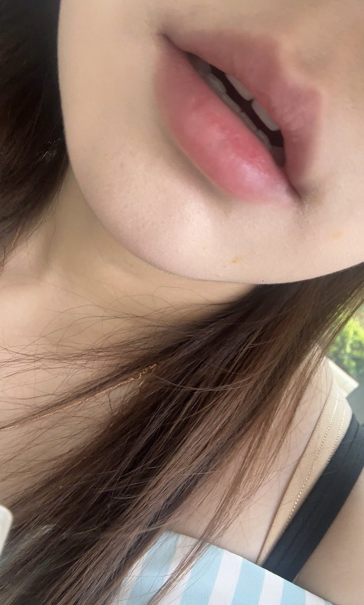 妈的今天嘴好好看，嘴上的油是吃了洋芋粑没纸擦哈哈哈 #昆明  #云南