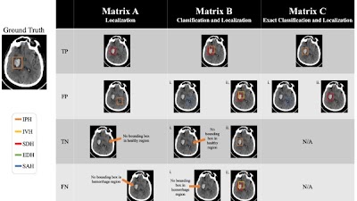 Radiology: Artificial Intelligence (@radiology_ai) on Twitter photo <a href="/ShahriarFaghani/">Shahriar Faghani MD</a> <a href="/Slowvak/">Brad Erickson</a> present Mondrian conformal prediction to estimate certainty in intracranial hemorrhage detection doi.org/10.1148/ryai.2… <a href="/MayoRadiology/">Mayo Clinic Radiology</a> #NeuroRad #AI #ML <a href="/ShahriarFaghani/">Shahriar Faghani MD</a> <a href="/Slowvak/">Brad Erickson</a> present Mondrian conformal prediction to estimate certainty in intracranial hemorrhage detection doi.org/10.1148/ryai.2… <a href="/MayoRadiology/">Mayo Clinic Radiology</a> #NeuroRad #AI #ML