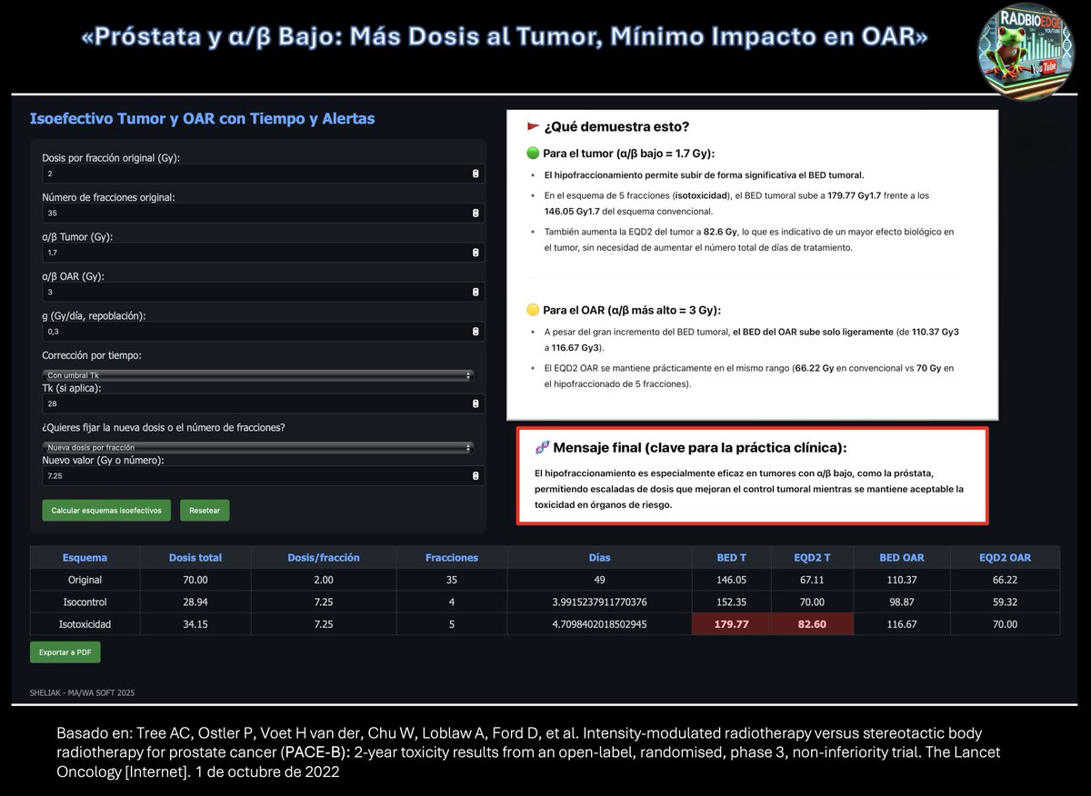 fichas #RADBIOEDGE  #hipofraccionamiento #radonc #pcsm #prostatecancer