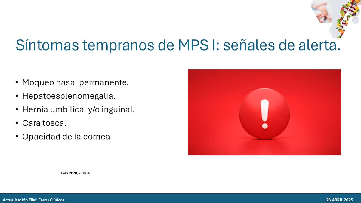 Pedro Lendinez #EnfermedadesRaras #MasVisibles (@pelendinez) on Twitter photo <a href="/HospitalLaFe/">HospitalLaFe</a> <a href="/Aecom_EIM/">AECOM, Asociación Española para estudio de los ECM</a> <a href="/AECOMySociedad/">AECOM&Sociedad</a> <a href="/OSIEECruces/">OSI EEC - Hospital Universitario Cruces</a> <a href="/SanofiES/">Sanofi España</a> <a href="/RarasReales/">Raras pero Reales</a> <a href="/Nutricia_es/">Nutricia España</a> <a href="/osakidetzaEJGV/">Osakidetza</a> El Dr. Antonio González-Meneses <a href="/pediatriaHUVR/">Pediatría y Áreas Específicas HUVR</a> del <a href="/HospitalUVRocio/">HospitalUVRocio</a> nos presenta el caso clínico de un paciente MPS I.
Señales de Alerta 🚨
- Moqueo nasal permanente
- Hepatoesplenomegalia
- Hernia umbilical y/o inguinal
- Cara tosca
- Opacidad de la córnea
#ActualizacionEIM <a href="/HospitalLaFe/">HospitalLaFe</a> <a href="/Aecom_EIM/">AECOM, Asociación Española para estudio de los ECM</a> <a href="/AECOMySociedad/">AECOM&Sociedad</a> <a href="/OSIEECruces/">OSI EEC - Hospital Universitario Cruces</a> <a href="/SanofiES/">Sanofi España</a> <a href="/RarasReales/">Raras pero Reales</a> <a href="/Nutricia_es/">Nutricia España</a> <a href="/osakidetzaEJGV/">Osakidetza</a> El Dr. Antonio González-Meneses <a href="/pediatriaHUVR/">Pediatría y Áreas Específicas HUVR</a> del <a href="/HospitalUVRocio/">HospitalUVRocio</a> nos presenta el caso clínico de un paciente MPS I.
Señales de Alerta 🚨
- Moqueo nasal permanente
- Hepatoesplenomegalia
- Hernia umbilical y/o inguinal
- Cara tosca
- Opacidad de la córnea
#ActualizacionEIM