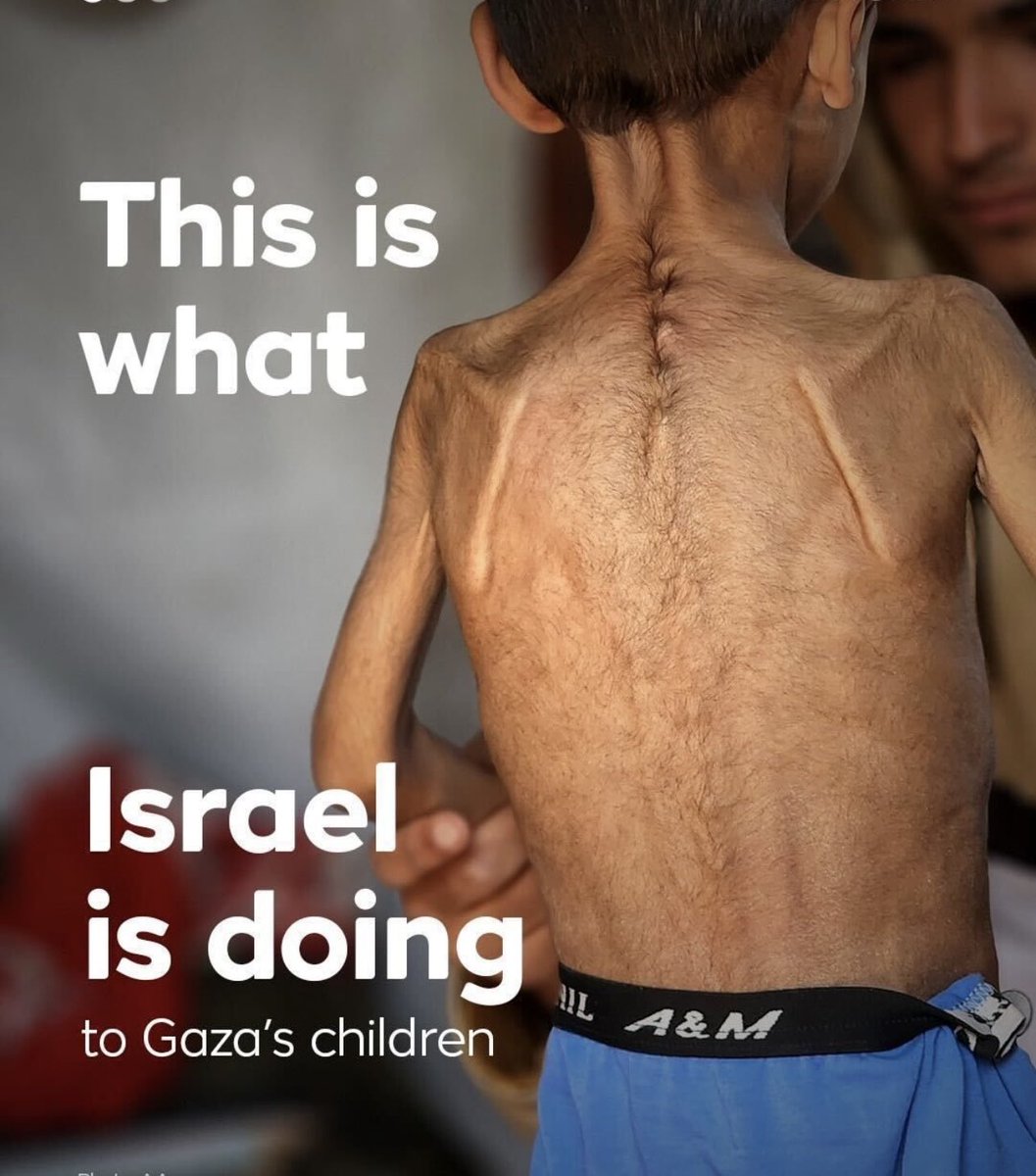 51 giorni da quando Israele ha imposto un assedio totale a Gaza. 
Niente farina, niente pane/cibo, neanche un goccio d'acqua o medicine sono entrati a Gaza.
I Bambini palestinesi muoiono di fame, o sotto le bombe, nell’indifferenza criminale del Occidente democratico. #Genocidio