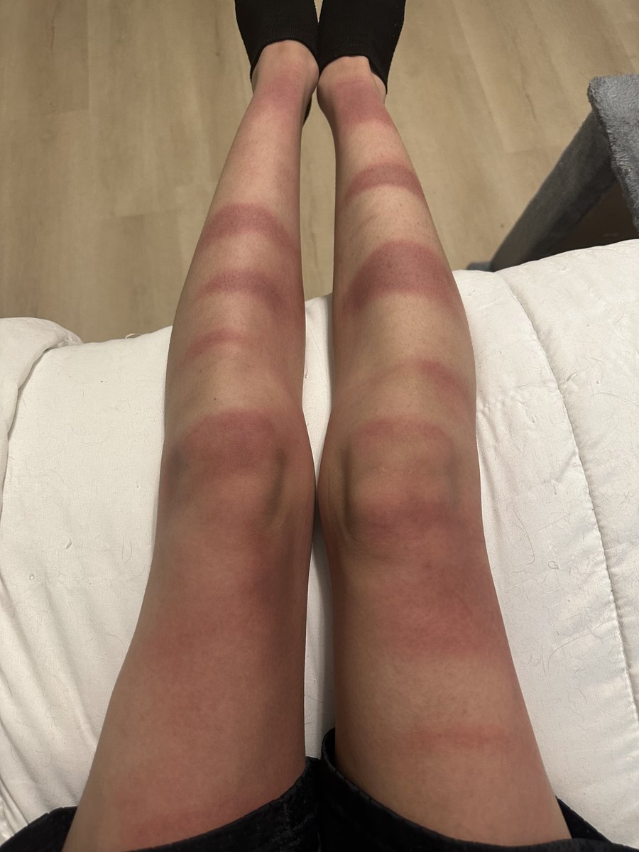 velxea's tweet photo. I mean my tan isn’t THATTT baddd right guys?? https://t.co/knsMT75oPJ