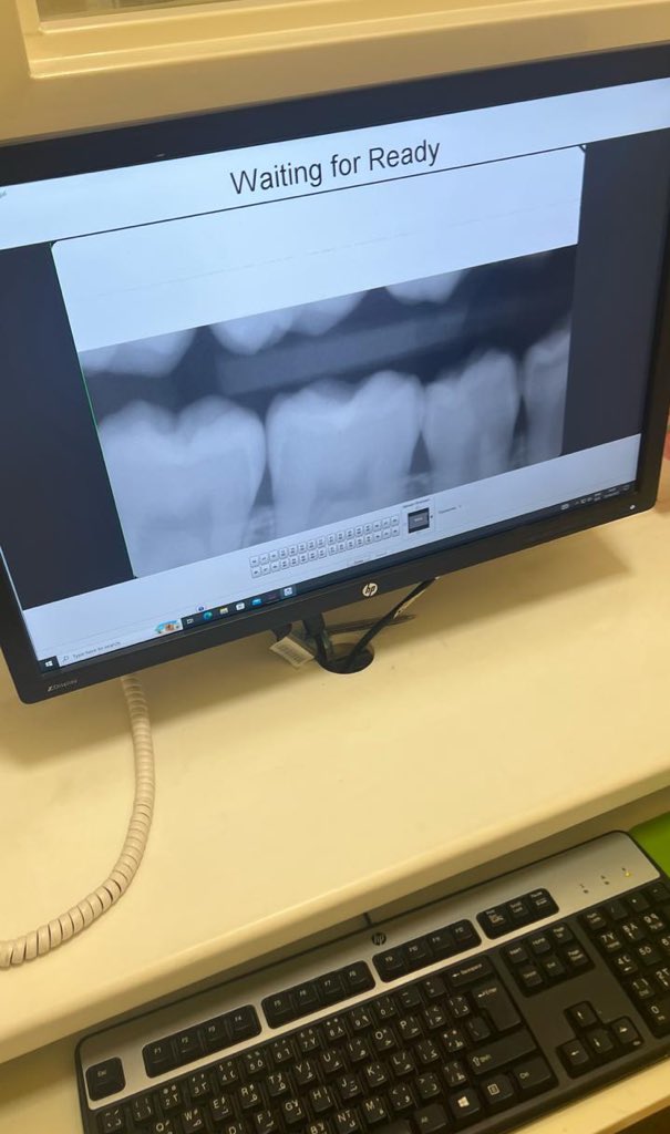 تم بحمدلله الانتهاء من فاينل أشعه عملي كانت تجربه جميله واستفدنا الكثير🩻🤍🤍