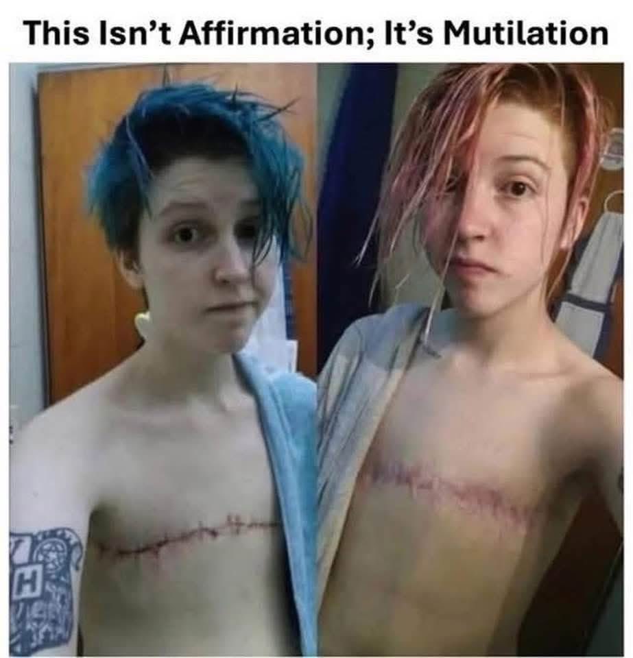 WeThePeople021's tweet image. Any surgeon that performs this type of surgery should lose their license.