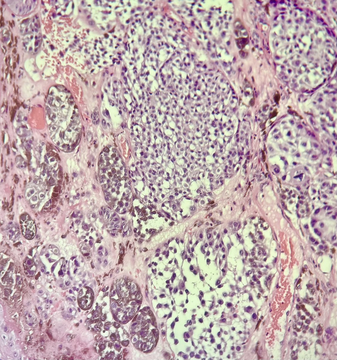 Francesco Fortarezza tweet media