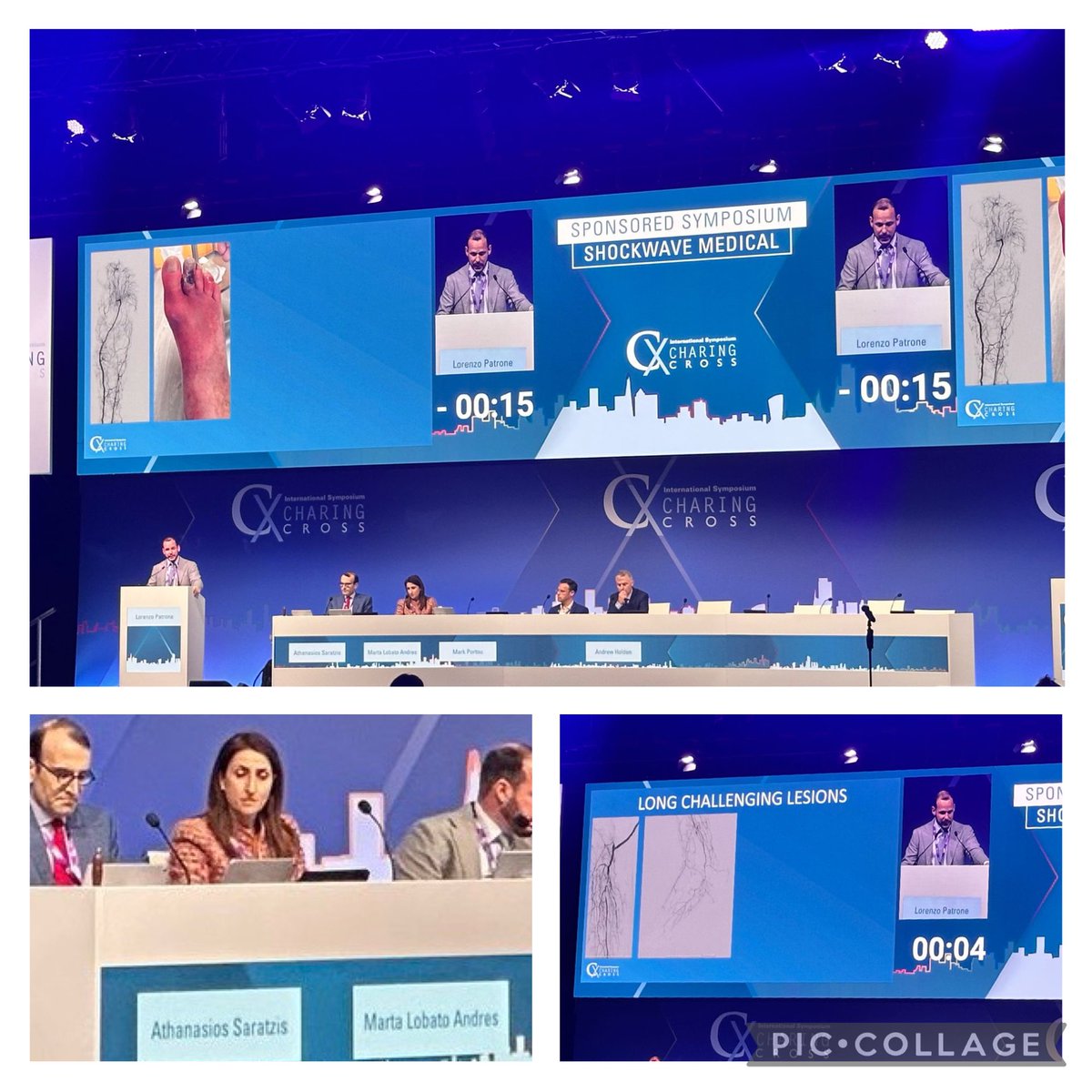 Overcoming the Challenges of Calcified CLTI”Session at #CX2025 was a blast! 
We explored cutting‑edge strategies that changing the game—from IVL insights to novel adjunctive techniques like Javelin.
Thanks to Shockwave Medical for making It possible