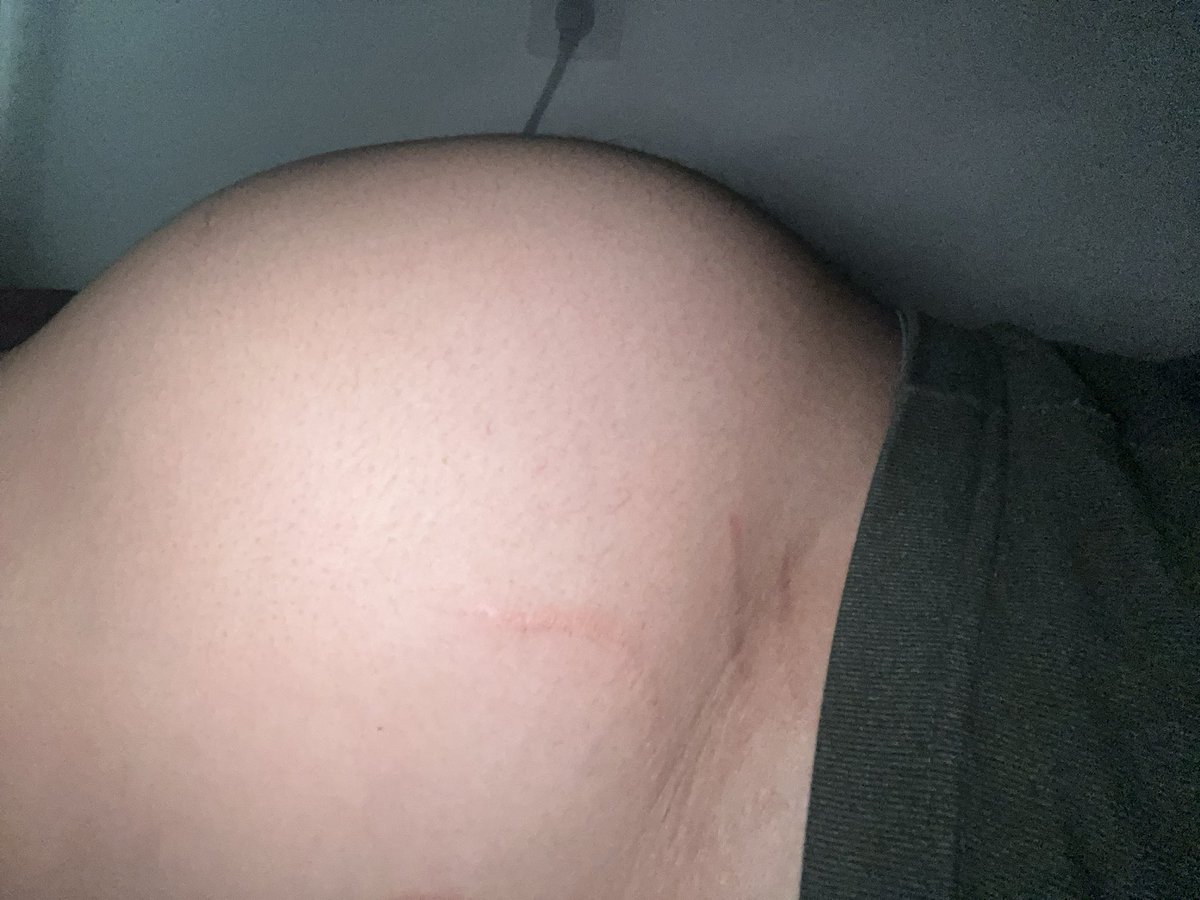 VLeparod's tweet photo. When you stuff yourself every day and don't go to the bathroom be like：
（How many days will my belly explode？🤔） https://t.co/i8As4IN9RF