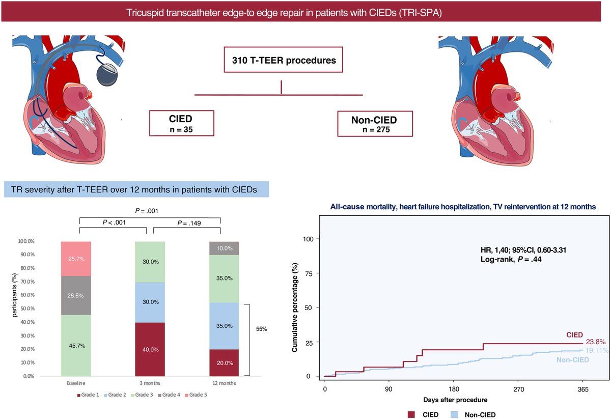 REC Publications (@revespcardiol) on Twitter photo Efficacy of transcatheter edge-to-edge repair for cardiac implantable electronic device-associated tricuspid regurgitation: insights from the TRI-SPA registry #REC #Aheadofprint <a href="/a_rubi_5/">Andrea Ruberti</a> <a href="/pedro_cepas/">Pedro Cepas</a>, <a href="/jcecharte/">Julio Echarte</a>, <a href="/StructuralBCN/">Dabit Arzamendi</a>, <a href="/VMonivas/">Vanessa Moñivas</a>, <a href="/MPAOSS/">Manuel Pan</a>, <a href="/luisnombela/">Luis Nombela-Franco</a>, <a href="/isaacpascual79/">Isaac Pascual</a>, Efficacy of transcatheter edge-to-edge repair for cardiac implantable electronic device-associated tricuspid regurgitation: insights from the TRI-SPA registry #REC #Aheadofprint <a href="/a_rubi_5/">Andrea Ruberti</a> <a href="/pedro_cepas/">Pedro Cepas</a>, <a href="/jcecharte/">Julio Echarte</a>, <a href="/StructuralBCN/">Dabit Arzamendi</a>, <a href="/VMonivas/">Vanessa Moñivas</a>, <a href="/MPAOSS/">Manuel Pan</a>, <a href="/luisnombela/">Luis Nombela-Franco</a>, <a href="/isaacpascual79/">Isaac Pascual</a>,