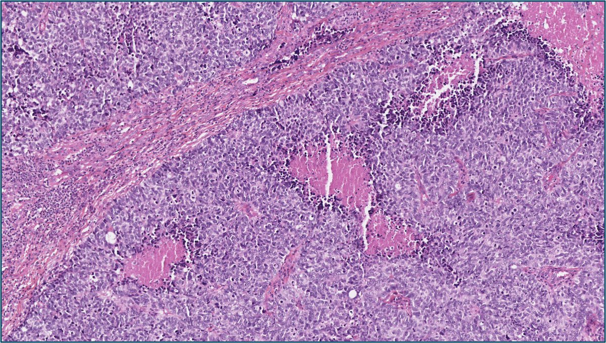 Ana-Maria Catana tweet media