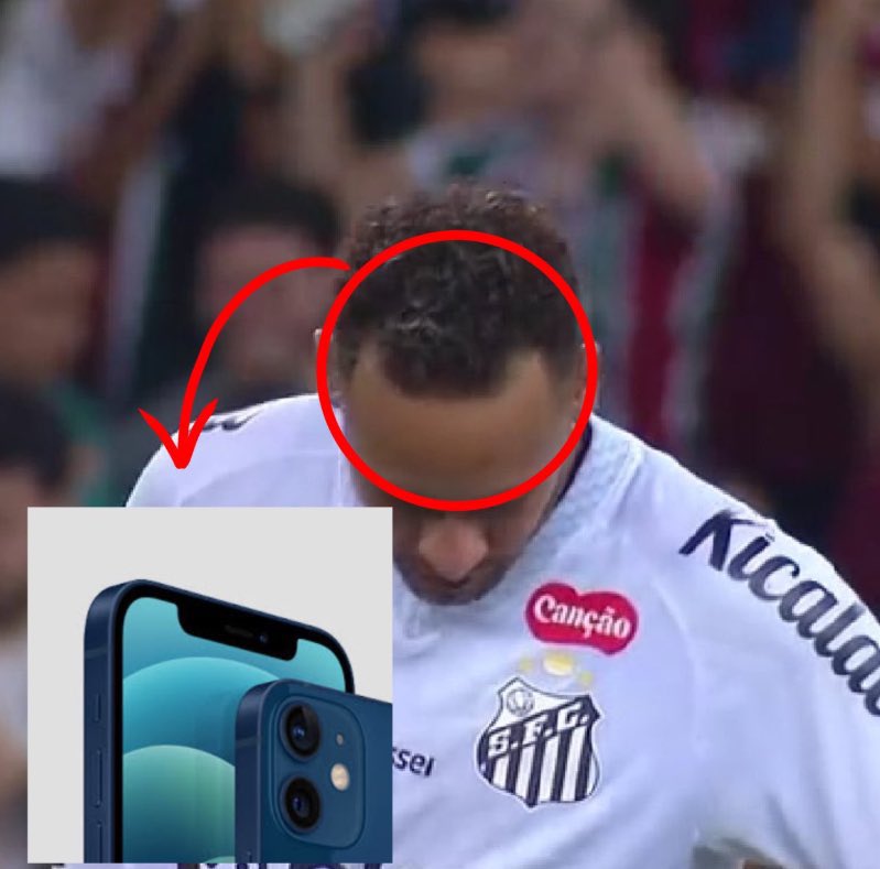 Clearman kullanmaktan bizim saç