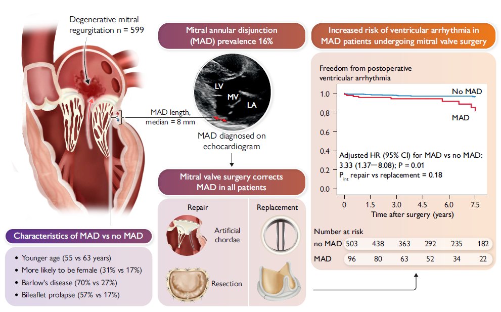 Victoria Delgado (@vdelgadogarcia) on Twitter photo La pregunta del millón: será el MAD con TV una nueva indicación para reparación mitral aunque la IM no sea severa? 🤔#cardioclinica25 <a href="/clinica_sec/">Asociación Cardiología Clínica SEC</a> <a href="/docvivas/">David Vivas</a> <a href="/Antonia_Sambola/">Antonia Sambola</a> La pregunta del millón: será el MAD con TV una nueva indicación para reparación mitral aunque la IM no sea severa? 🤔#cardioclinica25 <a href="/clinica_sec/">Asociación Cardiología Clínica SEC</a> <a href="/docvivas/">David Vivas</a> <a href="/Antonia_Sambola/">Antonia Sambola</a>